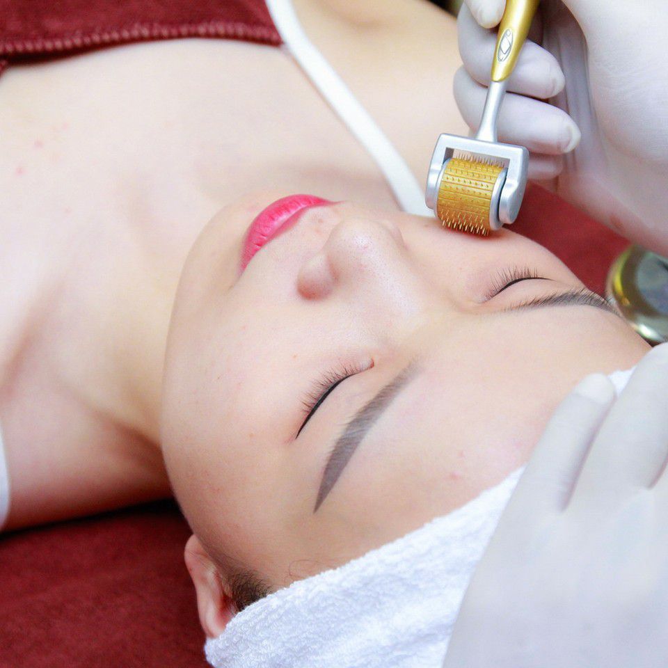 Chăm sóc da sau khi lăn kim như thế nào là đúng cách?