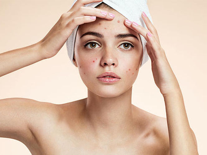 cách chăm sóc da mặt sau khi nặn mụn