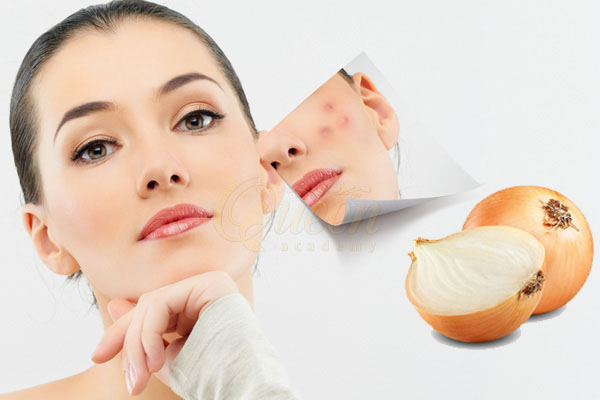 công dụng làm đẹp của hành tây