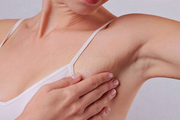 các mẹo trị thâm nách bằng phương pháp tự nhiên