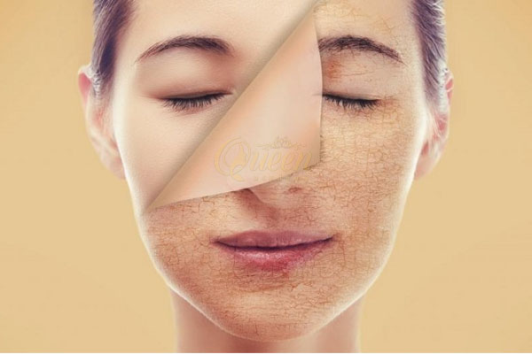 mẹo chăm sóc da và chọn mỹ phẩm phù hợp với da khô