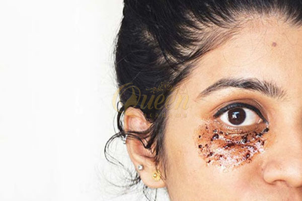 Cà phê giúp làm mờ quầng thâm mắt