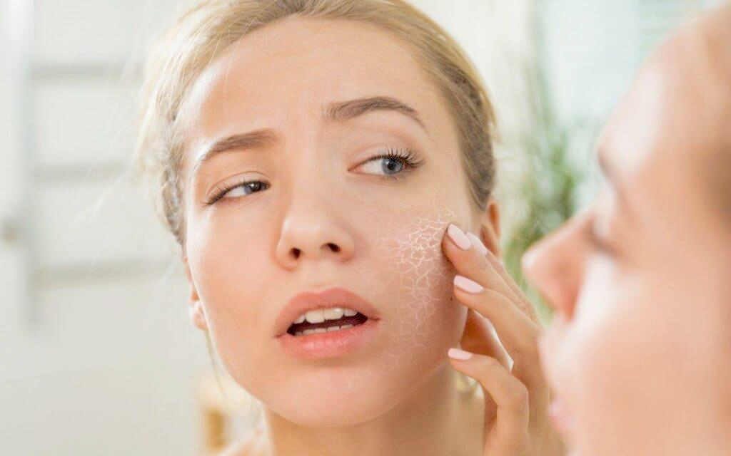 Da khô có thể liên quan đến các bệnh 1024x640 - Cách chăm sóc da mặt khô đơn giản hiệu quả tại nhà