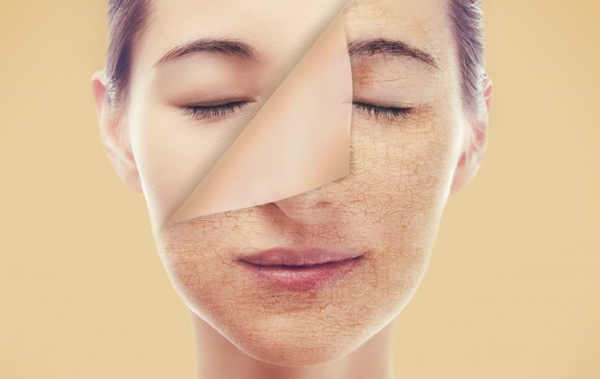 Da khô phải làm sao - Cách chăm sóc da mặt khô đơn giản hiệu quả tại nhà