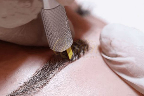 Có chế độ ăn uống thích hợp