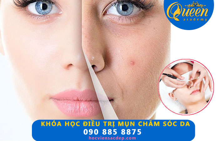 Khóa học điều trị mụn – chăm sóc da chuyên nghiệp