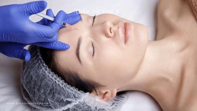 Xóa nếp nhăn bằng botox