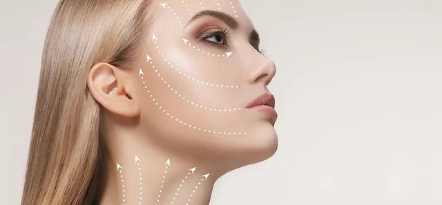 Hiệu quả thần kỳ của căng da mặt và da cổ bằng chỉ collagen không phải ai cũng biết