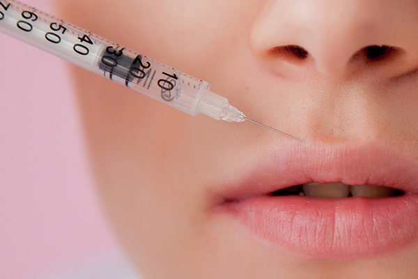 lợi ích tiêm filler môi