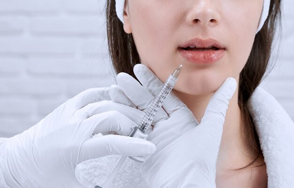 mẹo phòng tránh tiêm filer môi hỏng