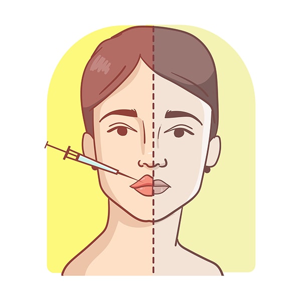 Tiêm filler môi có đau không?