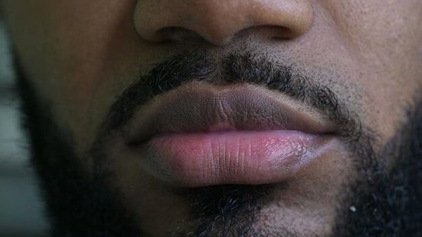 Tìm hiểu tình trạng thâm môi ở nam giới