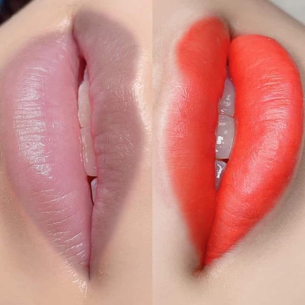 Khử thâm môi có lên màu không