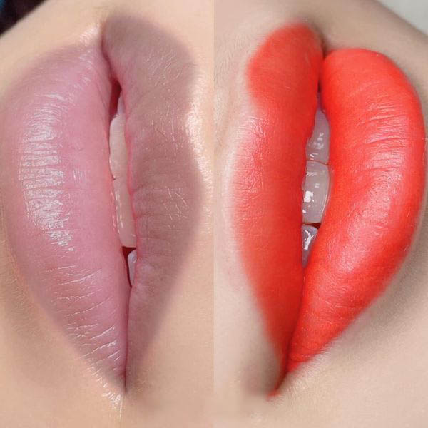 quá trình Khử thâm môi có đau không