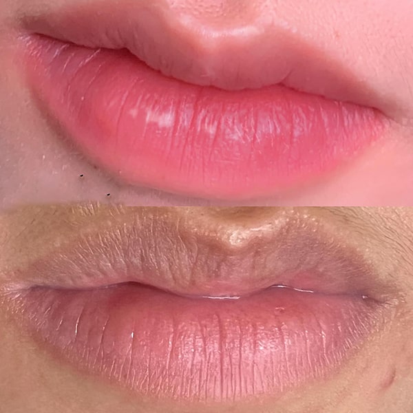 Nên khử thâm môi hay phun môi