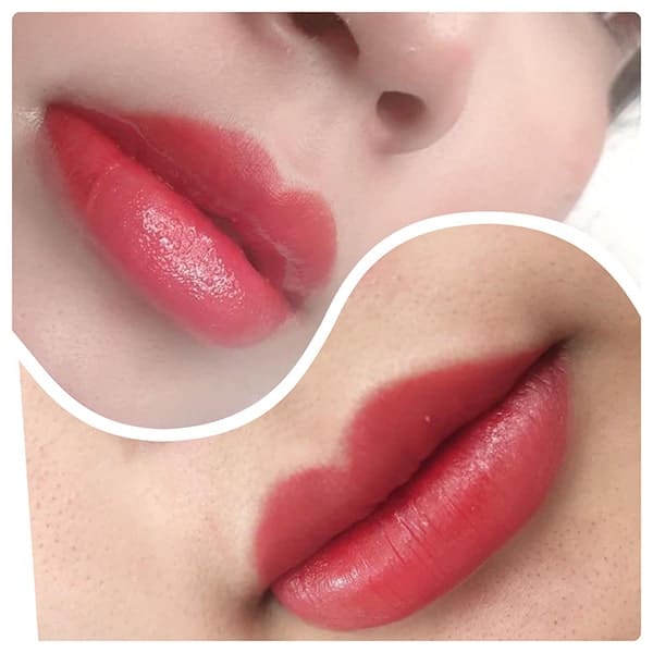 Phun môi bị chảy nước vàng