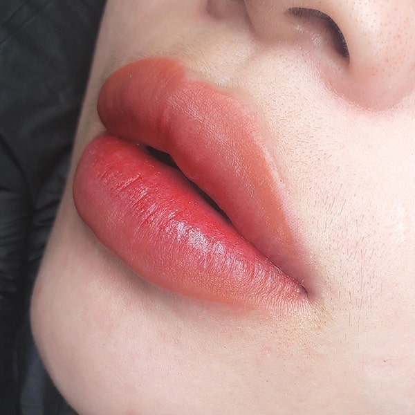 Phun môi tế bào gốc