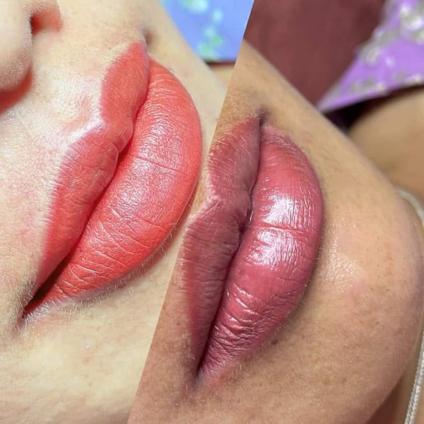 Phun môi xong bị thâm đen