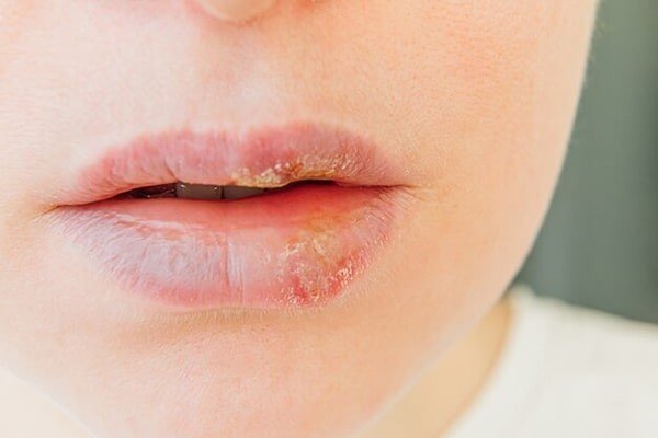 Phun xăm môi có hại không?