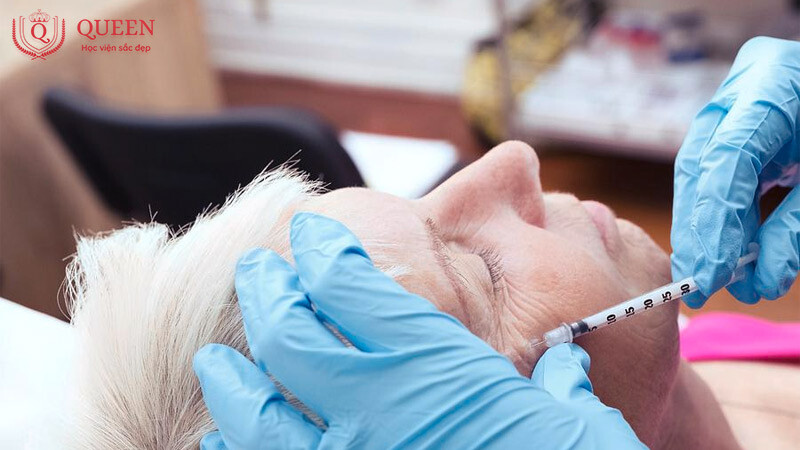 luu-y-khi-hoc-tiem-botox