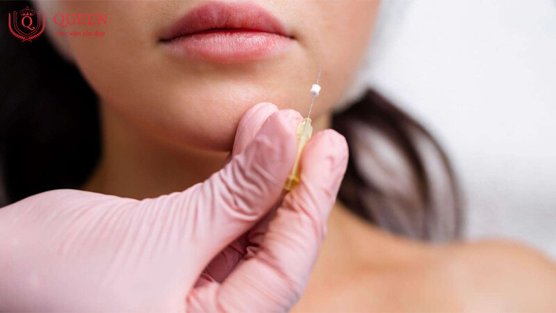 luu-y-khi-tham-gia-khoa-hoc-cay-chi-tham-my