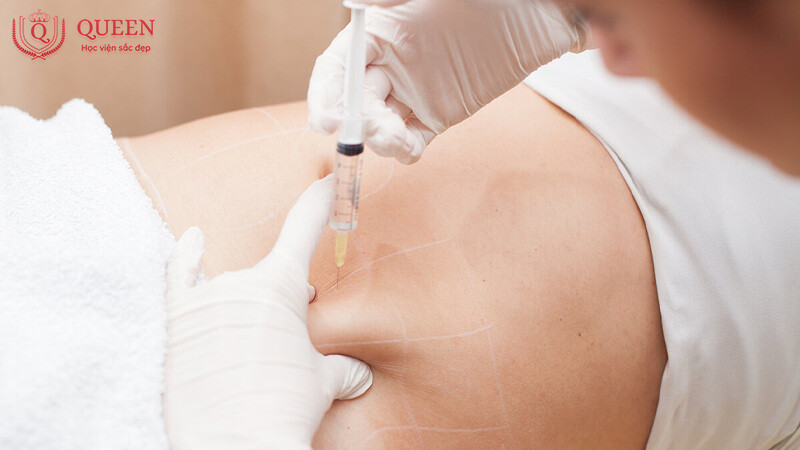 thoi-gian-va-chi-phi-hoc-tiem-tan-mo