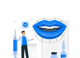 Tiêm filler dáng môi tây