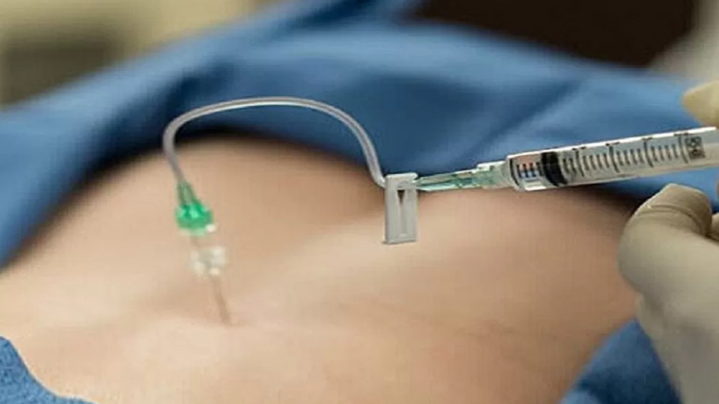 Thủy châm - phương pháp điều trị kết hợp y học hiện đại và y học cổ truyền