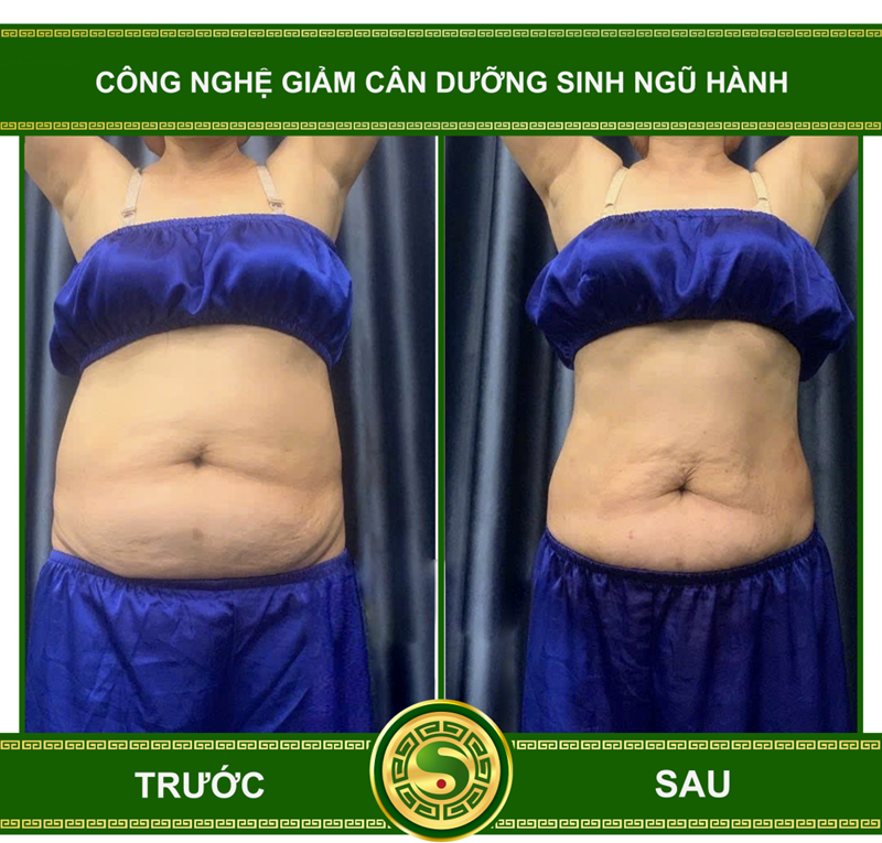 Công nghệ giảm mỡ sinh học