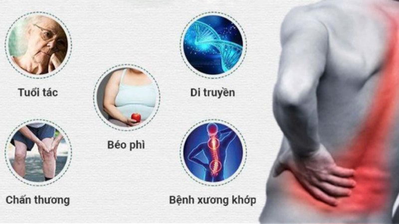 Một số nguyên nhân dẫn đến tình trạng gai cột sống 