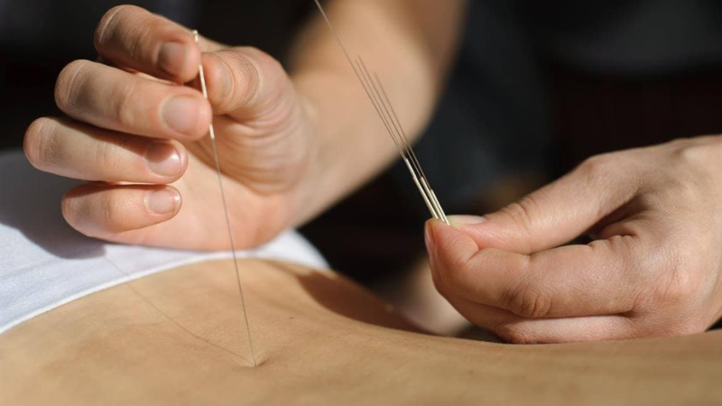 Châm cứu đông y chữa gai cột sống