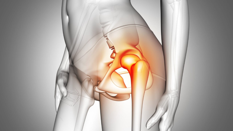 Phương pháp chữa viêm khớp háng bằng đông y