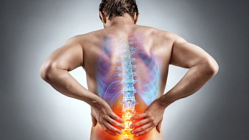 Triệu chứng của thoát vị đĩa đệm