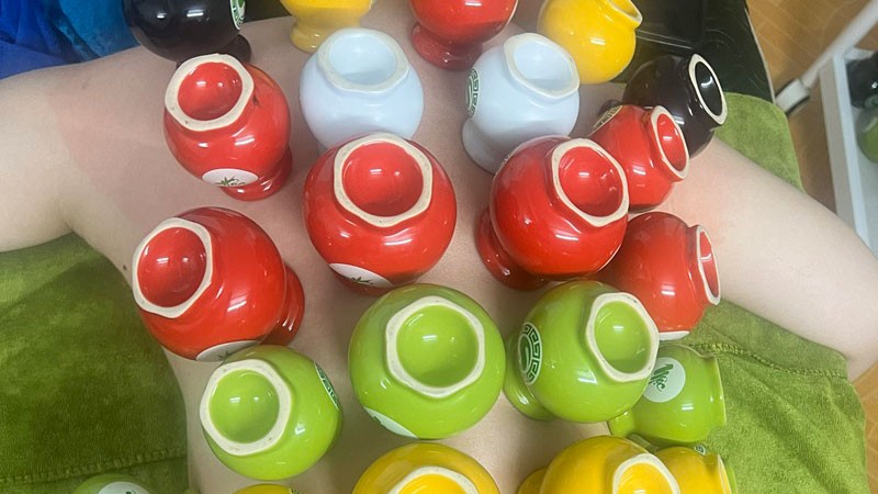 Sử dụng liệu pháp giác hơi để khai thông kinh lạc