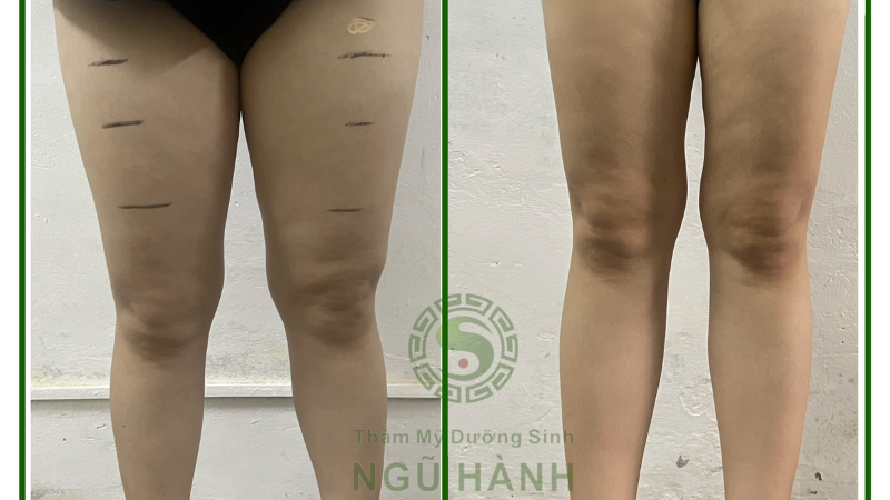 Khóa học giảm cân tại Đông Y Ngũ Hành