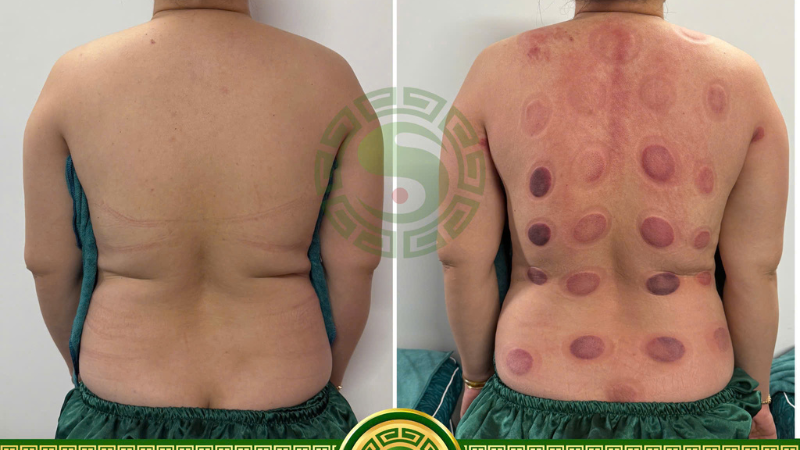 Tại sao nên chọn học nghề Đông Y tại Đông Y Ngũ Hành?